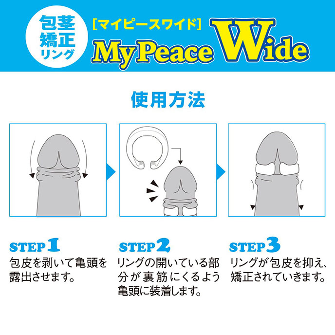 My Peace Wide Standard 包莖矯正環-寬 M size (日用)
